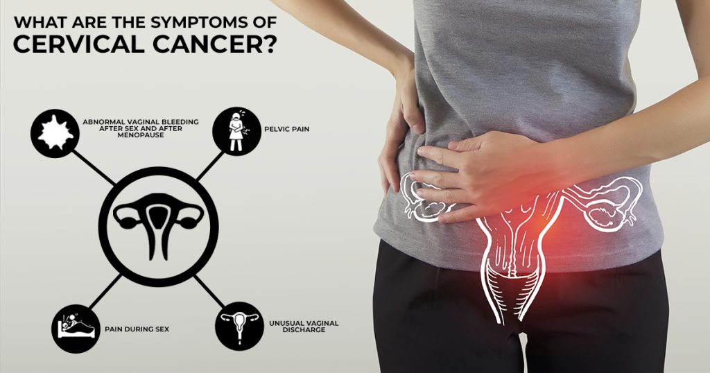 Symptoms of Cervical Cancer | Poonam Pandey